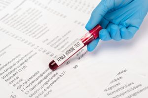 Cropped view of doctor holding test tube with sample of female hormone near lists with hormones